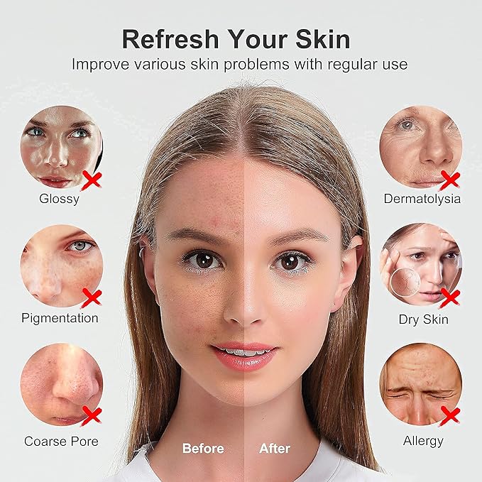 Newbealer Facial Steamer, Mini Aroma Face Steamer, Nano Ionic Hot Mist Face Humidifier for Facial Deep Cleaning, Home Sauna Spa Sprayer with 9 Pieces Acne Remover Kit (White-Gold, 160 ml)