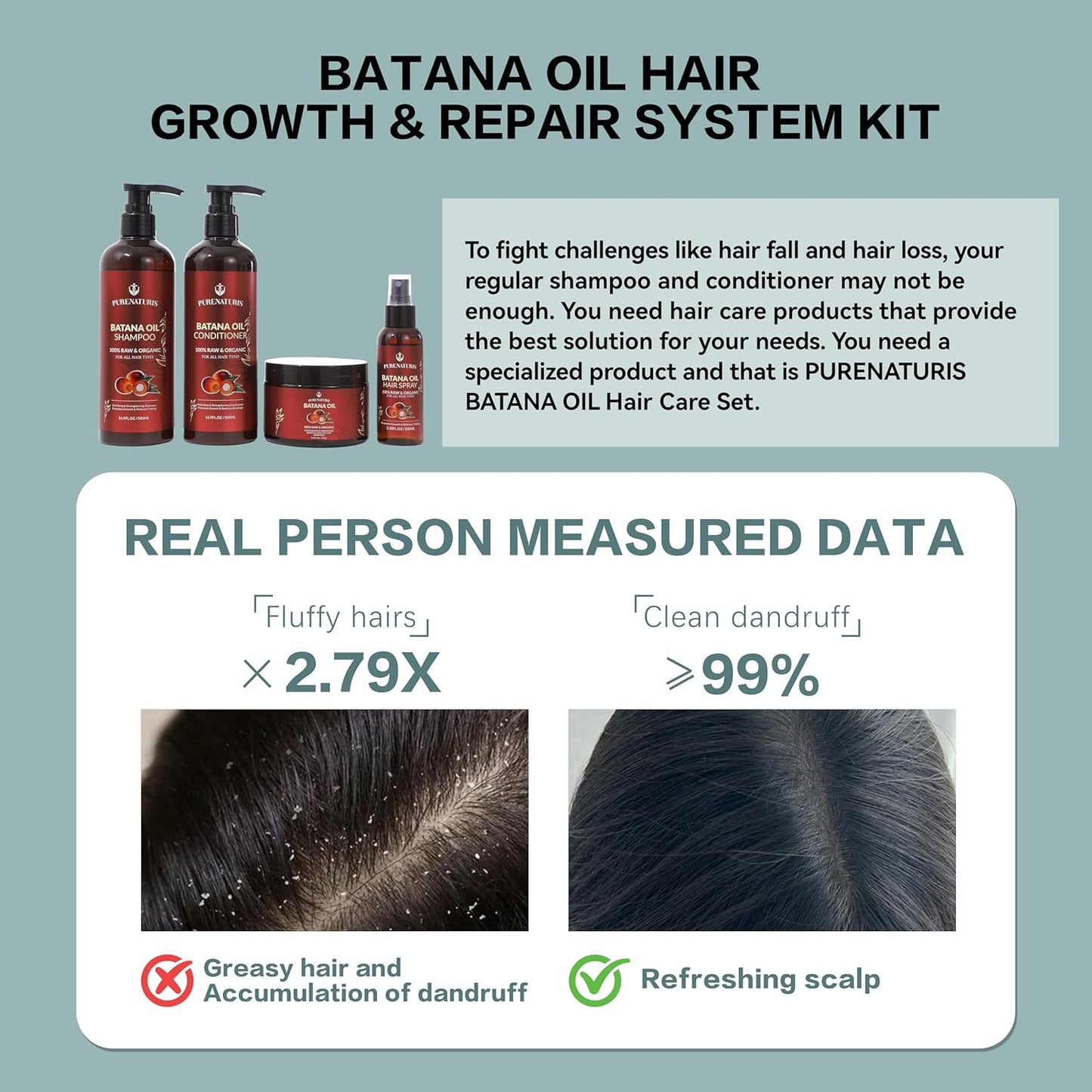 100% Natural Raw Organic Batana Oil Sulfate-Free Complete Hair Growth , Anti-Hair Loss & Repair System Kit – Shampoo, Conditioner, Hair Mask, & Leave-In Spray | Thickness & Prevents Loss for Men Women