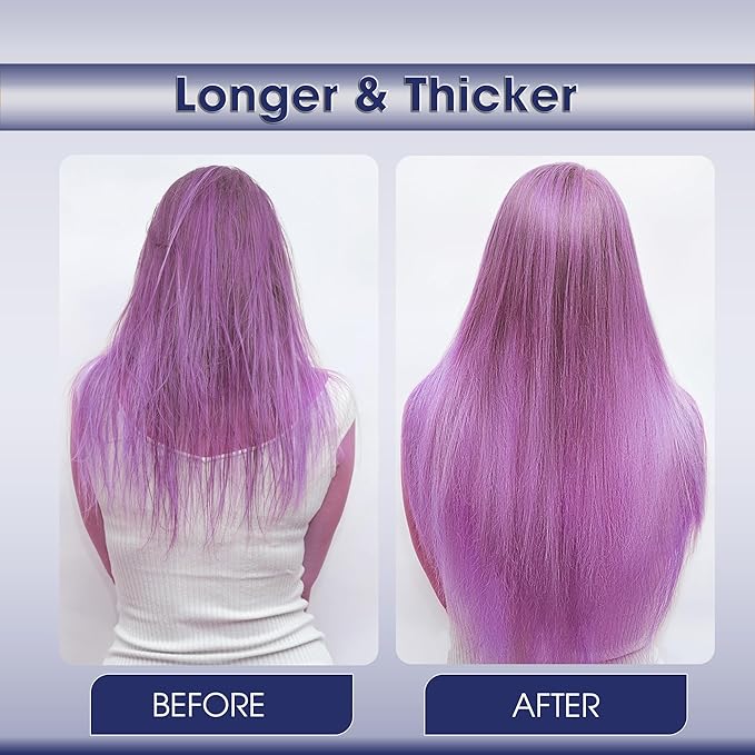 Dry Scalp Serum for Hair Growth - Improves Scalp Health to Promote Hair Grow Longer Thicker Stronger Fuller & Shinier, Hair Scalp Oils for Hair Growth Non-greasy, No Sticky Residue.