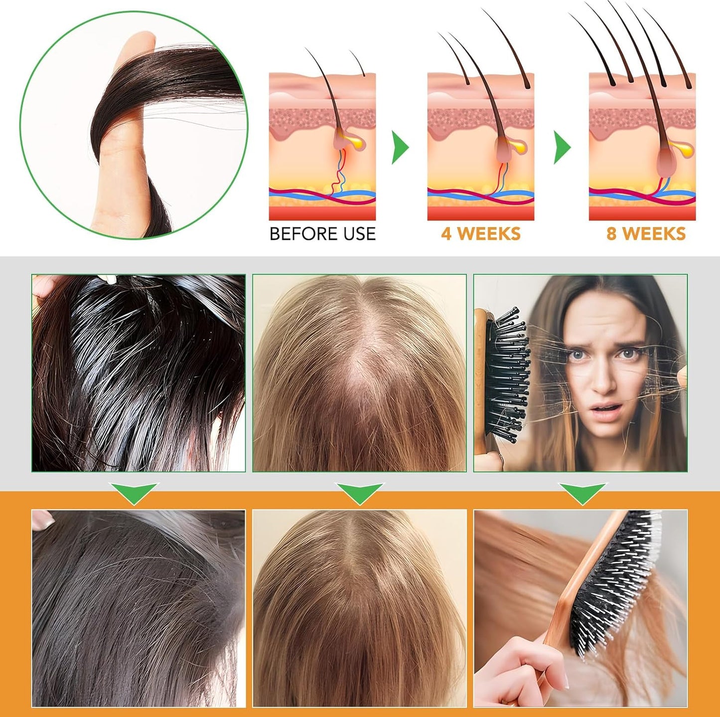 Biotin Shampoo and Conditioner for Hair Loss| Thickening Hair Products with Rosemary, Black Castor & Batana Oil - Strengthens, Repair, Add Shine for Women Curly, Straight, Dry and Damaged Hair