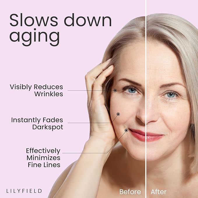 LILYFIELD Wrinkle Correcting Serum with Phyto Collagen & Vitamin C. Korean Skincare. Anti-Aging, Target Dark Spots and Fine lines,Smoothing, All Skin Types. Korean Skin care 30ml, 1 fl. oz