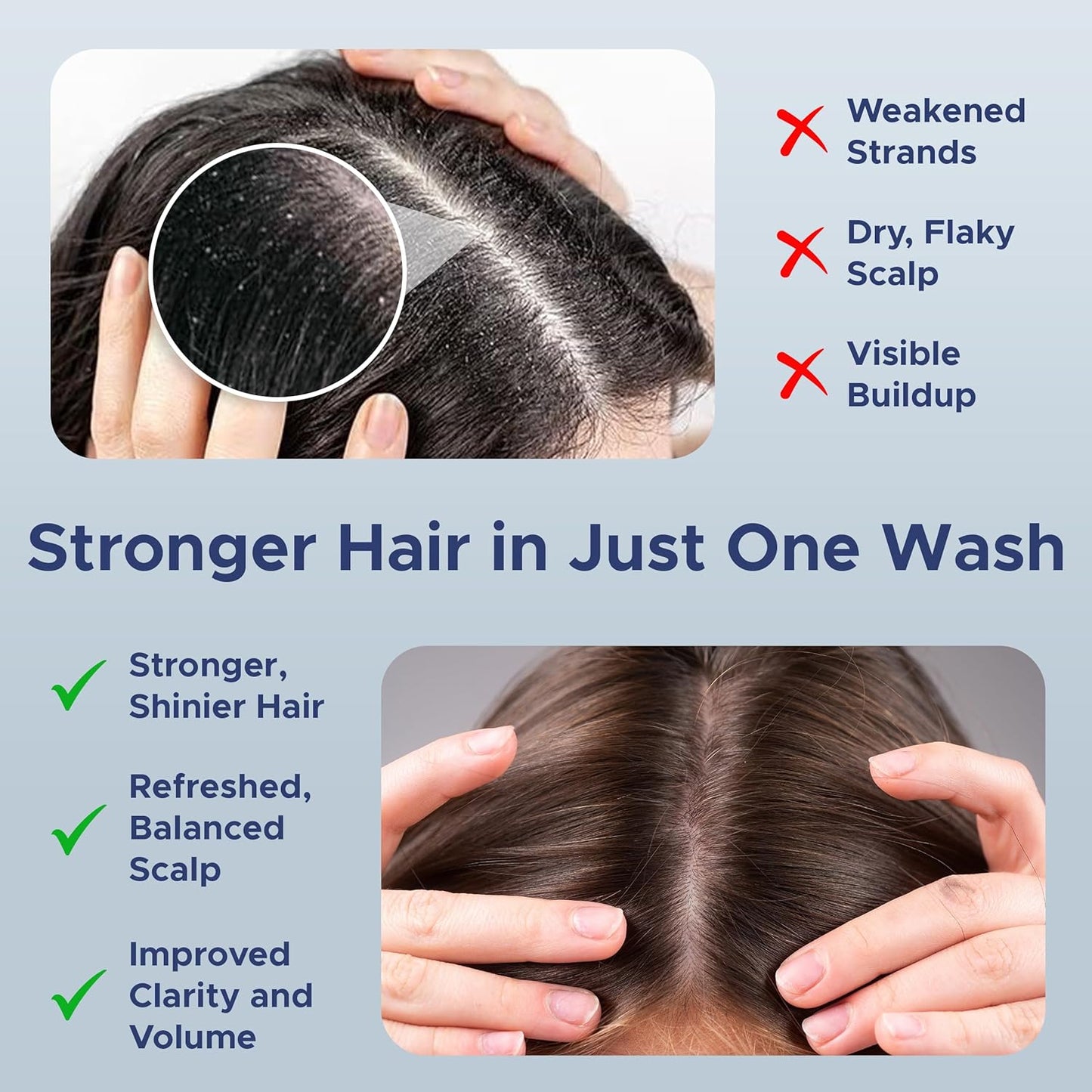 Nora Ross Garlic Extract Hair Strengthening Shampoo – Thickening Shampoo for Women and Men with Normal to Dry, Thinning Hair – All Natural Anti-Dandruff and Scalp Cleanser with Rosemary – 32oz