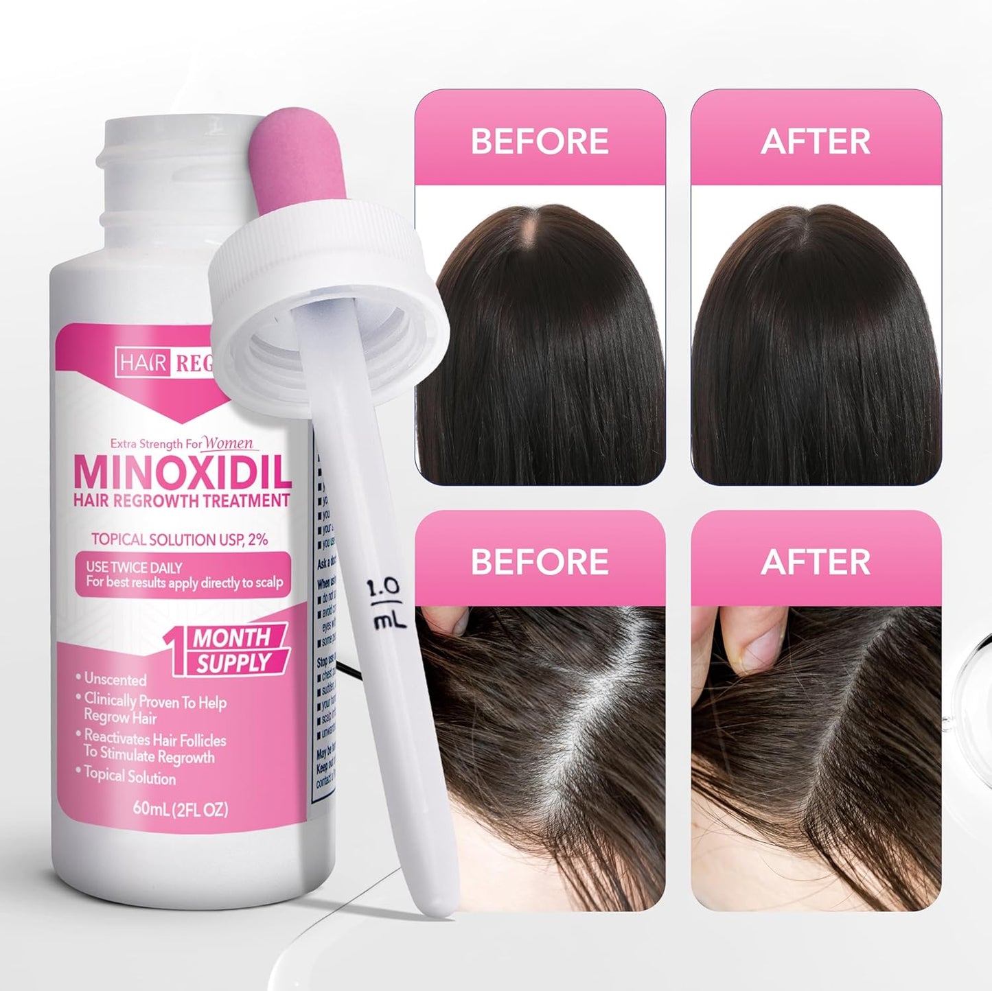 Minoxidil For Women 2% Hair Regrowth Treatment for Women, 1-Month Supply, Unscented, 2 fl oz
