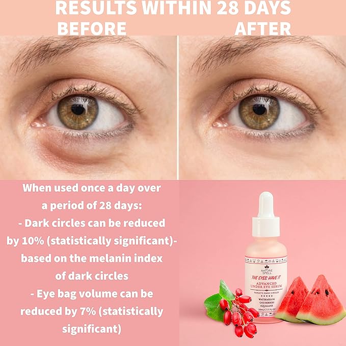 Nature Spell Advanced Under Eye Serum with Watermelon & Goji Berries 1 Fl Oz– Targets Dark Circles, Puffiness & Eyebags – Anti Wrinkle Under Eye Cream - 100% Vegan – Made in the UK