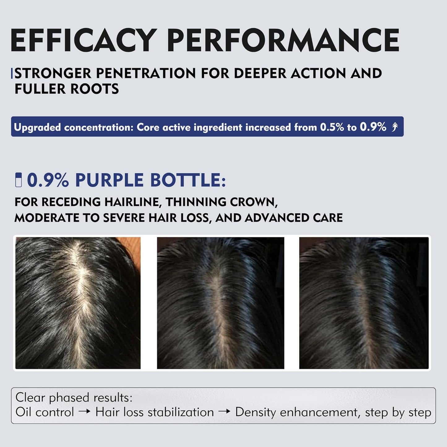 KINTOR 0.9% KX-826 DHT Blocker for Men & Women Hair Growth,Hair Growth Products Spray 60ml Pro