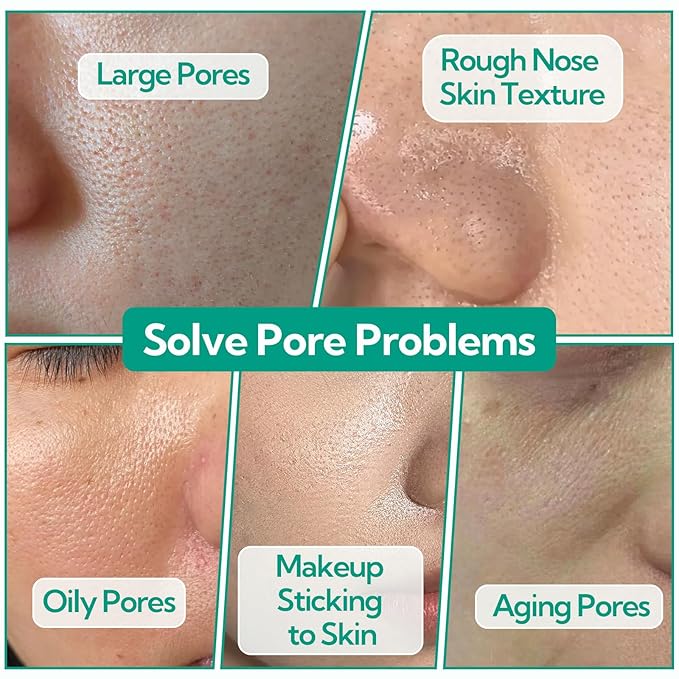 Pore Minimizer Serum， BREYLEE Pore Refining Serum for Face & Nose, Oil Control Firming, Shrinking Pore & Tightening Skin, Pore Moisture after Blackhead Remover, Clam and Soothing Skin Care