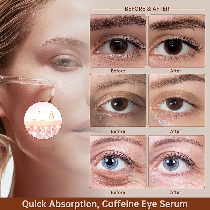 Caffeine Solution 5% + EGCG For Dark Circles & Puffiness, 30ML Anti Aging Under Eye Serum For Eye Bags, Fine Lines, Moisturizing Caffeine Solution.