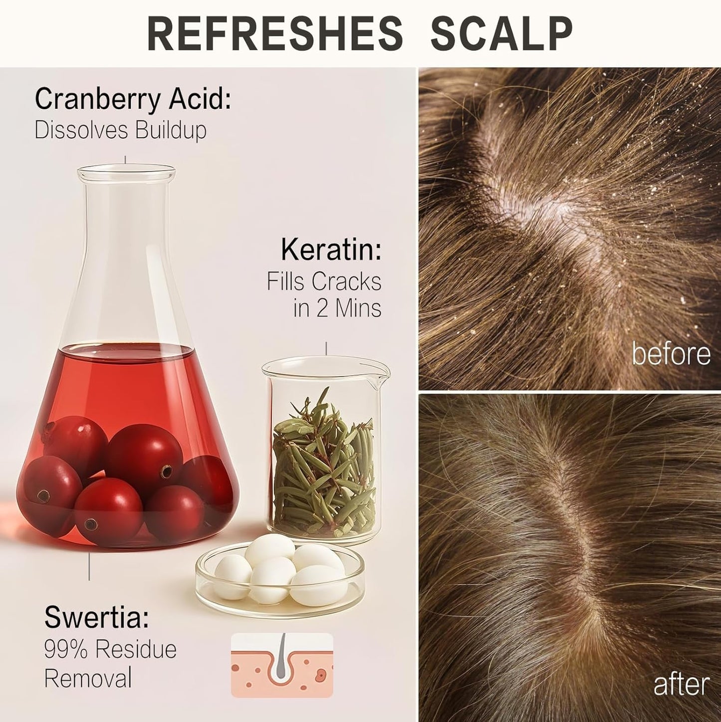 DEMIKI Japanese Shampoo and Conditioner Set for Women, Shampoo and Conditioner Set for Oily Hair, Sulfate Free, Rose Scent, Anti Dandruff, Clarifying, Moisturizing, Hydrolyzed Keratin Hair Care, 32oz