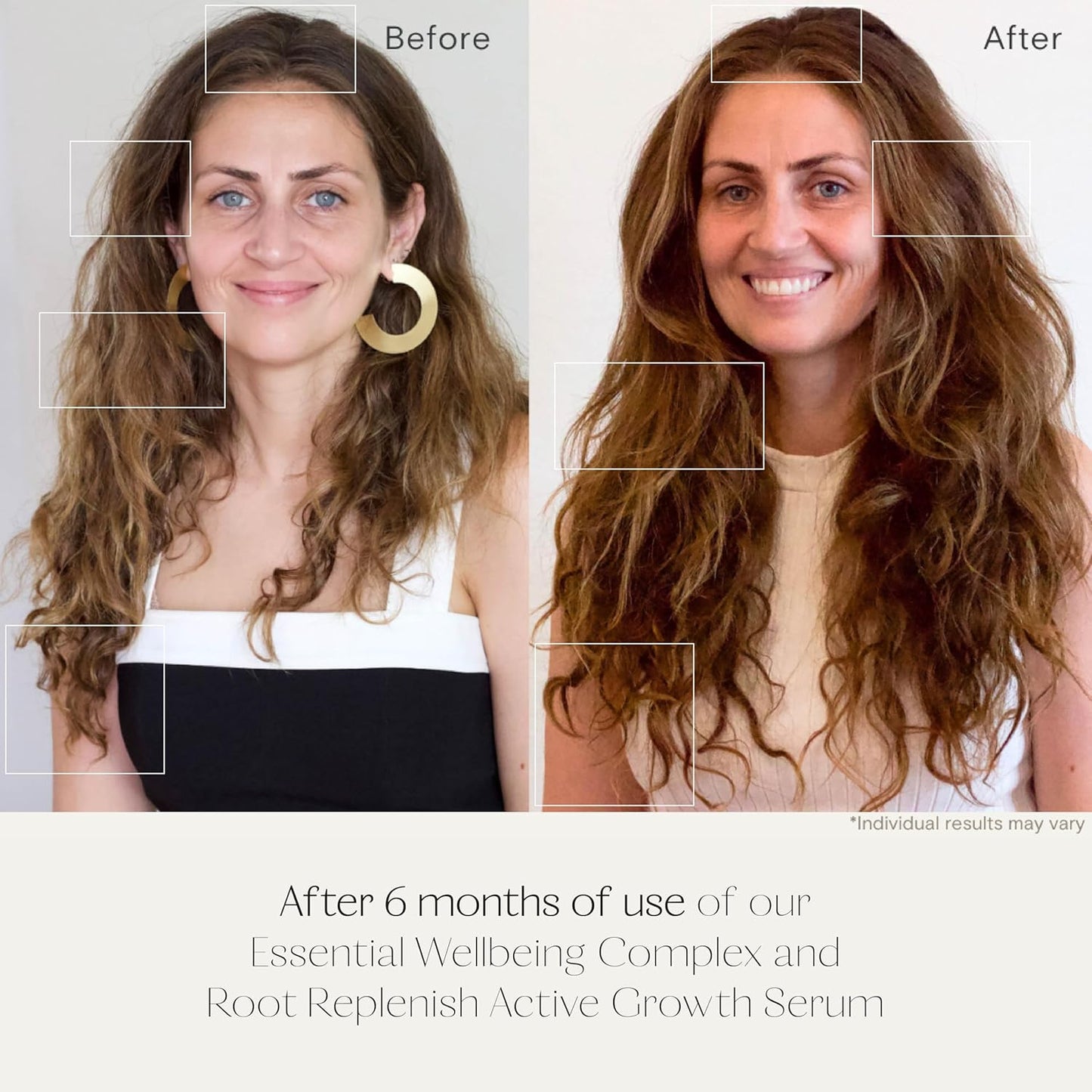 Root Replenish Active Growth Serum | Thicker-Feeling, Denser & Fuller Hair Support | Microbiome-Balancing, Resveratrol & DHT-Blockers | Lightweight Scalp Treatment | 1 fl oz