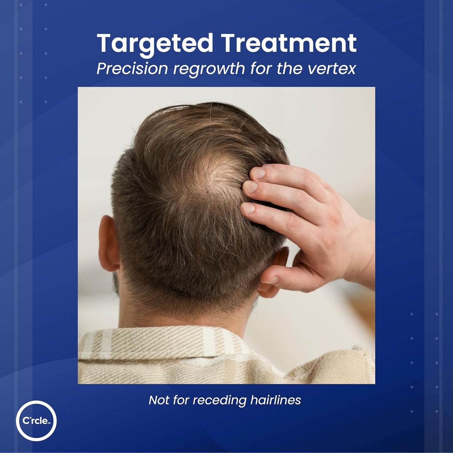 C’rcle Men's Minoxidil 5% Foam - Unscented 6 Month Supply - Helps Restore Vertex Hair Loss & Thinning - Extra Strength Supports Hair Regrowth for Men