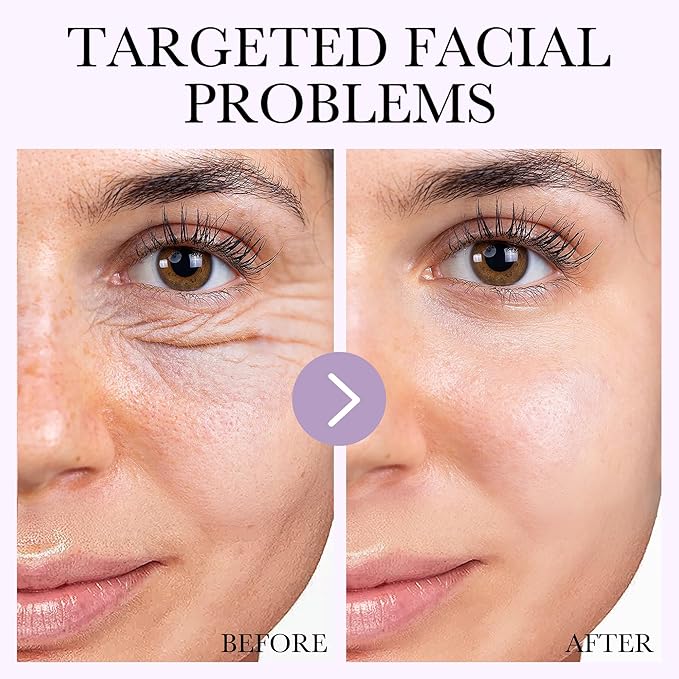 Deep Bio-Collagen Real Mask 34g*6ea, Facial Hydrogel Masks with Low Molecular Weight Collagen, Hydrating Overnight Mask for Moisturizing, Pore Minimizing, Firming, Elasticity, Wrinkle, Easily Absorbed