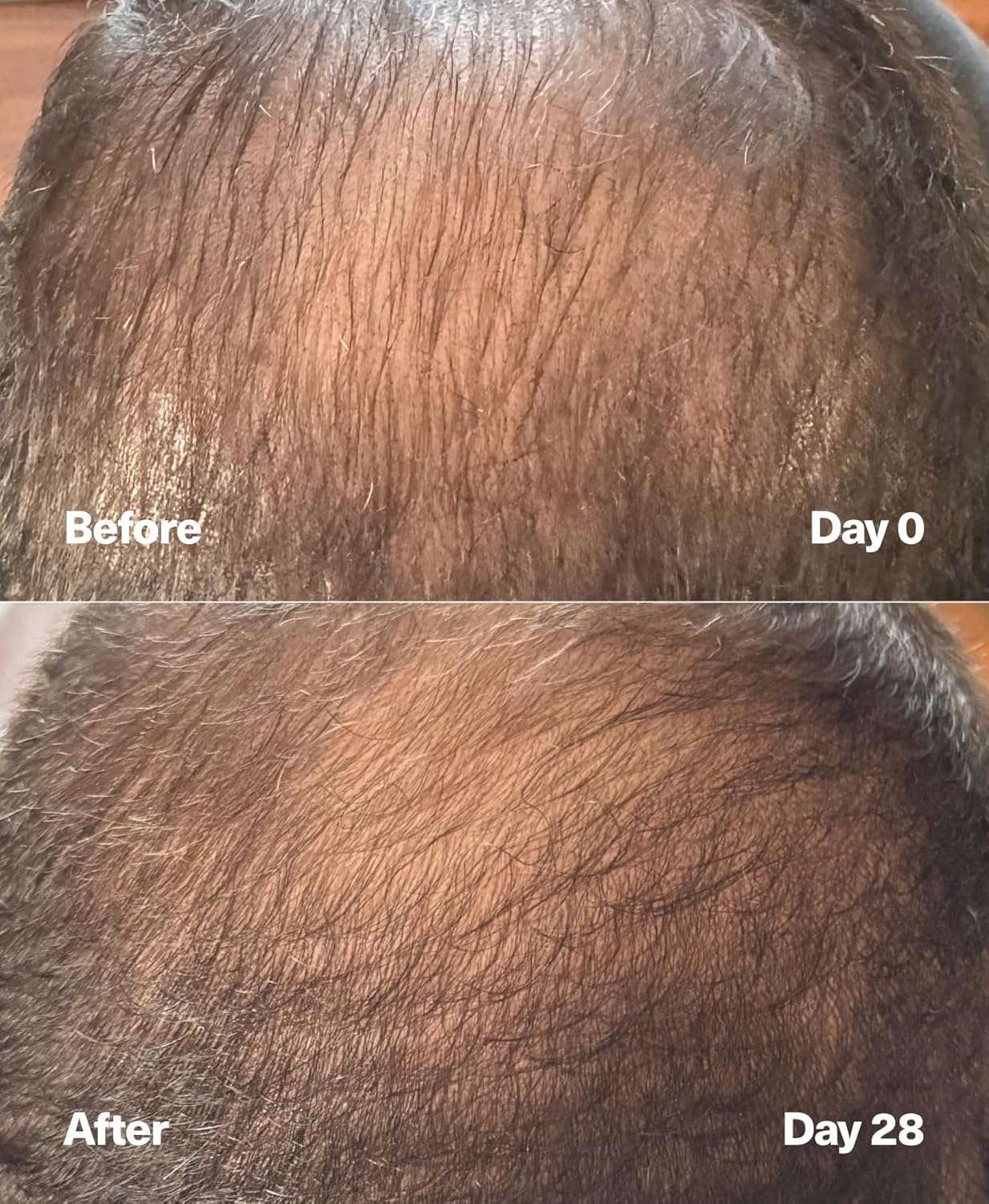 SickScience PowerCycle Exosome Hair Growth Serum - Clinically Advanced Scalp Treatment for Thinning Hair, Hair Loss Prevention & Regrowth - Lightweight Formula for Women & Men, Without Minoxidil, 60mL