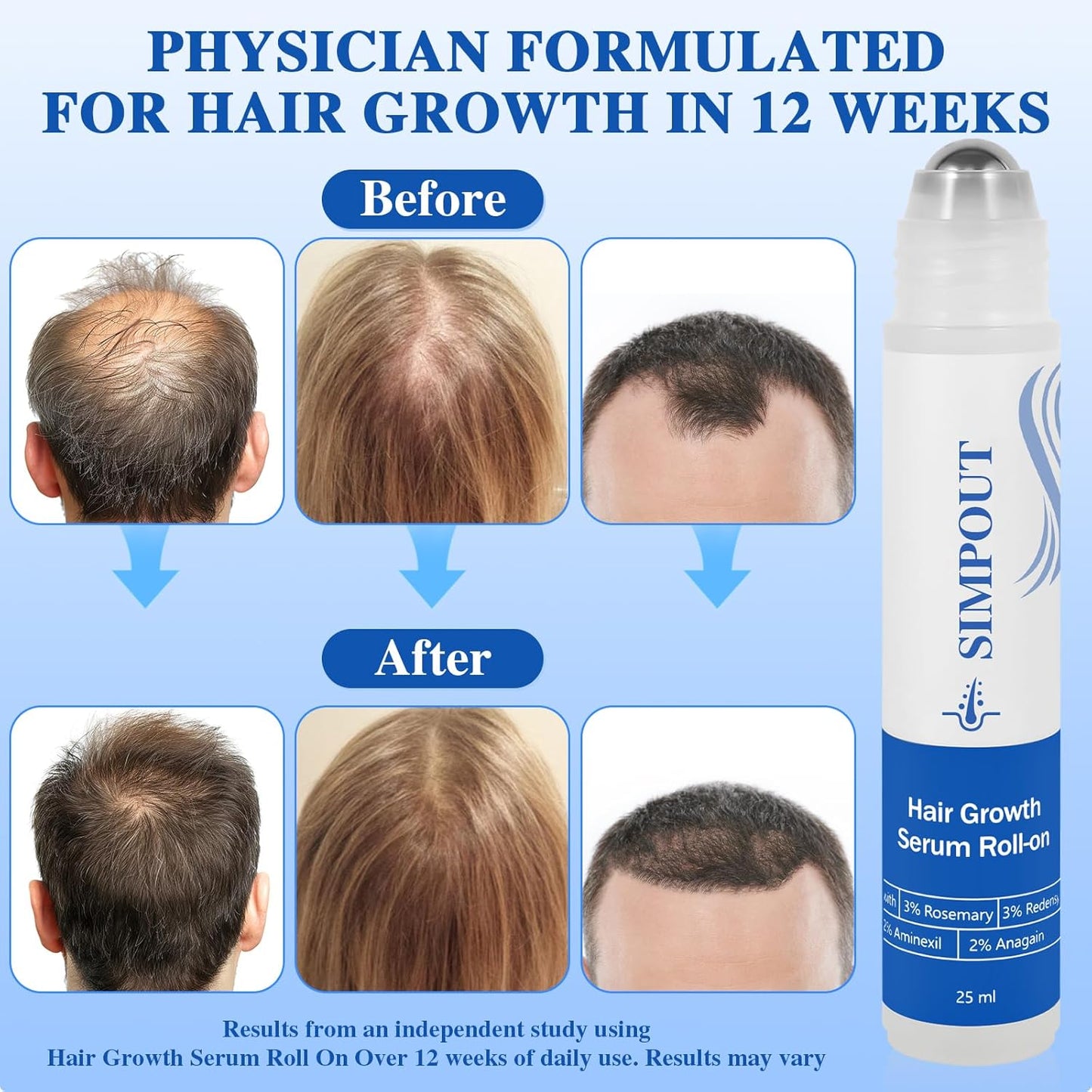 Rosemary Hair Growth Serum Roll On, Nourishing Scalp Hair, Thicker & Stronger Hair, Reduces Hair Fall, Suit for Women Men, For All Hair Types(Rosemary)