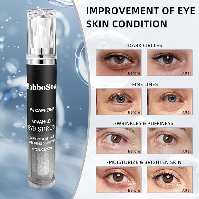 5% Caffeine Eye Serum, Anti-Aging Eye Cream with 360°Massage Roller, Eye Serum for Dark Circles and Puffiness, Reduces Fine Lines and Puffiness Under the Ryes, 20ML, For Men and Women.