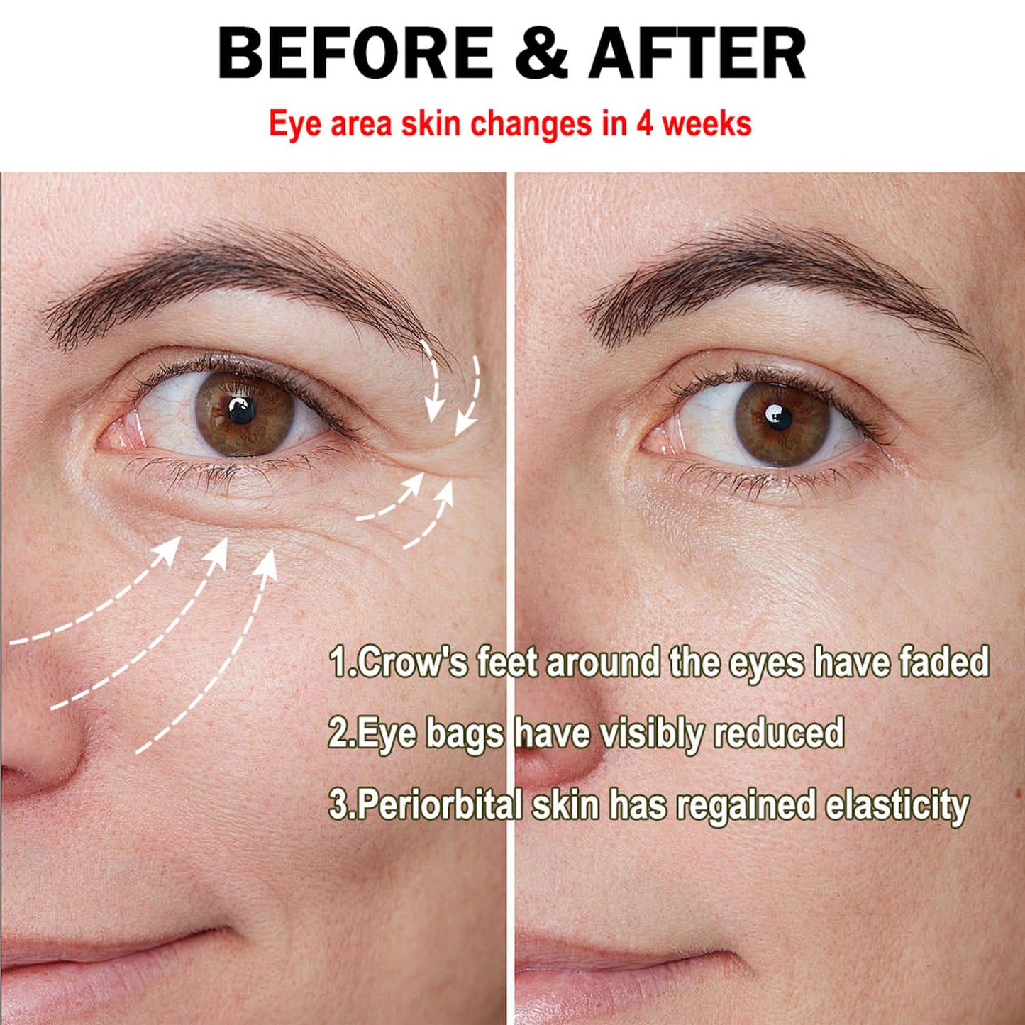 Anti Aging Eye Cream with Hyaluronic Acid & Vitamin E – Hydrating Under Eye Cream for Visible Wrinkles & Bag Appearance, Helps Visibly Tighten & Reduce Puffiness