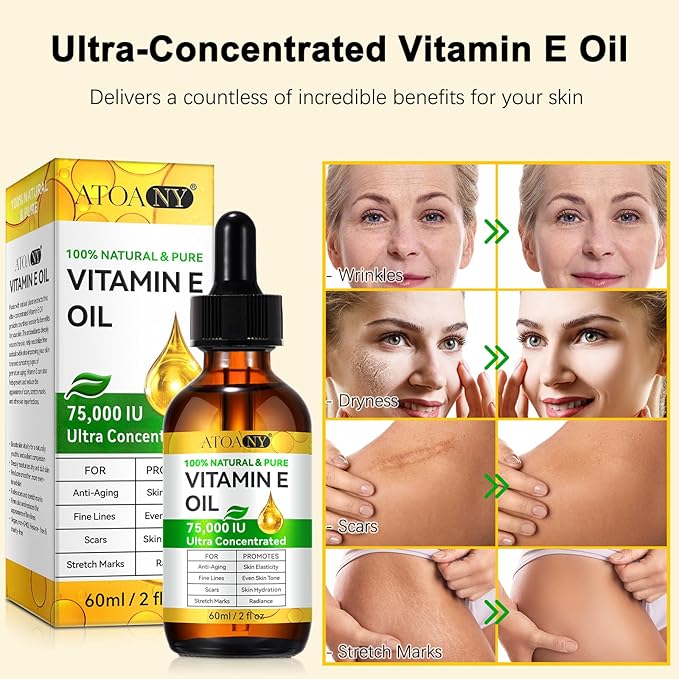 Vitamin E Oil 75,000 IU – 100% Pure Natural Vitamin E for Skin, Face, Hair, Scars – Deep Moisturizing Body Oil for Dry Skin, Wrinkles – Cold-Pressed, Non-GMO,Organic Skincare – 2 Fl Oz