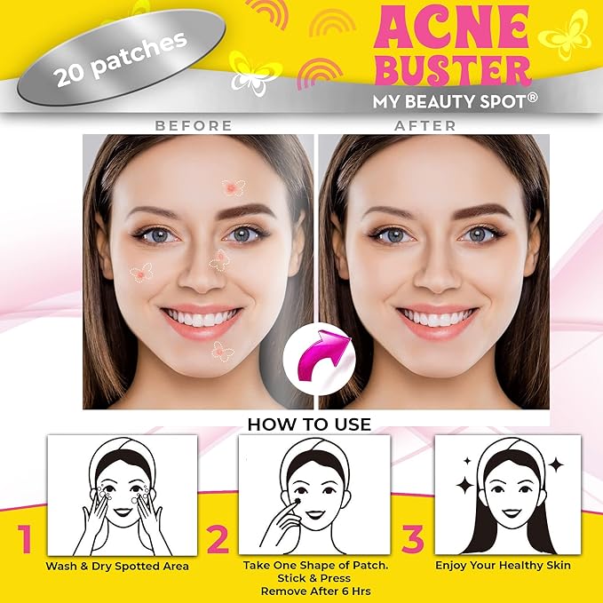 My Beauty Spot Pimple Patches Cute Acne Patches for Face 20 Pcs with Tea Tree Extra & Salicylic Acid, Butterfly and Rainbow Colorful Fun Designs – Pimple Patches for Face Acne Spot Treatment