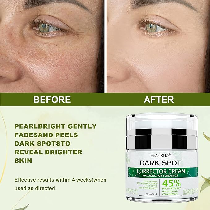 Dark Spot Remover Corrector for Face and Body, Dark Spot Corrector Cream,Moisturizer-Remover Sun Spot, Age Spot,Melasma, Freckles,Brown Spot Hyperpigmentation for Men and Women