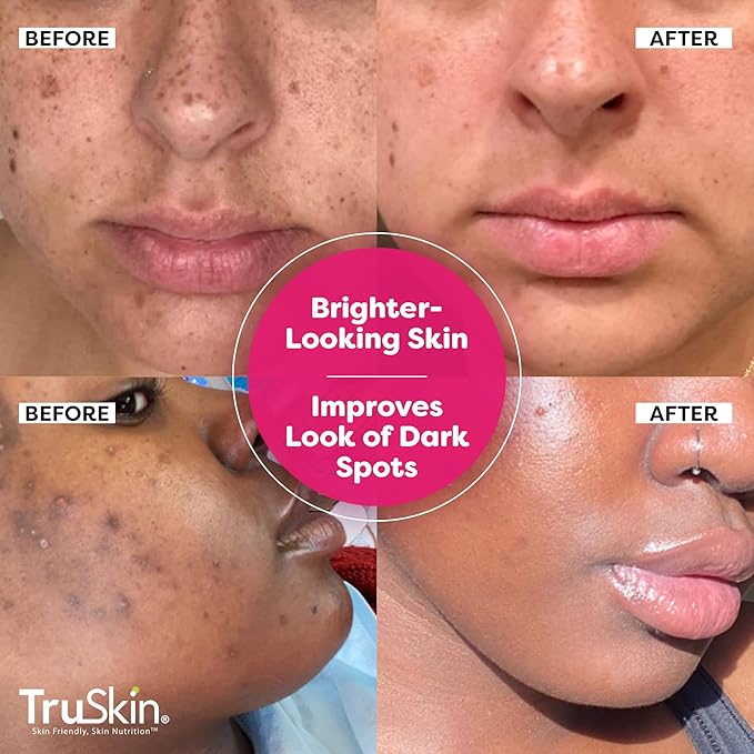 TruSkin Vitamin C Super Serum - Niacinamide, Retinol, Hyaluronic & Salicylic Acid - All-in-One Anti Aging Serum for Face – Improve Appearance of Dark Spots, Firmness for Brighter Looking Skin, 2 Fl Oz