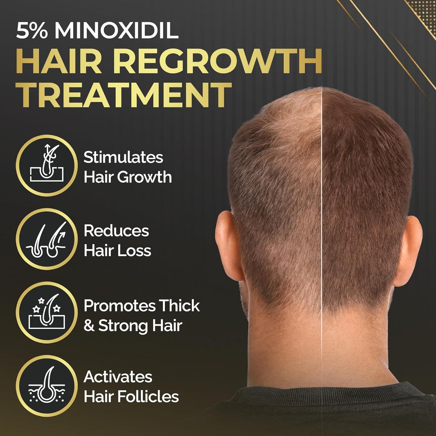 Elevate Hair Regrowth Treatment 5% Minoxidil Solution for Hair Growth - Extra Strength Topical Hair Growth Serum for Thicker, Fuller Hair 2 Fl Oz Made in USA