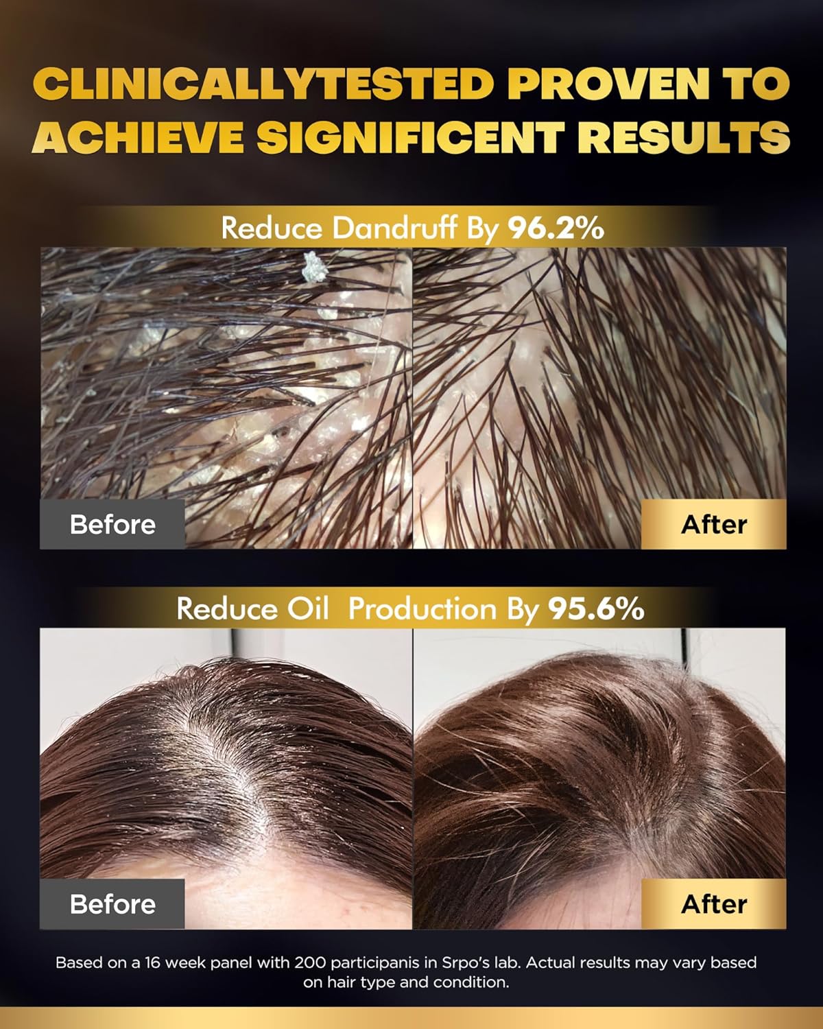 Tripeptide-Infused Hair Growth Biotin Shampoo and Conditioner Set, Onion Anti-Loss Volumizing Moisturizing Treatment for Soft Shine Hair, Dandruff Routine Rosemary Shampoo for Men and Women, 2x16.9oz