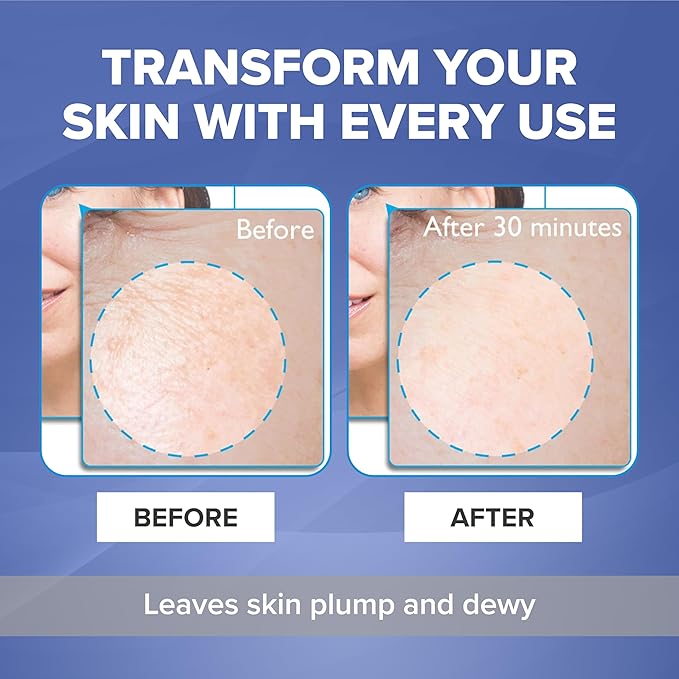 BIO-luminance Silicone Hydrotherapy Masque – Skin Care Face Mask with Advanced Silicone Gel Technology to Help Tighten Fine Lines & Wrinkles - Hydrating Facial Mask Reusable Up to 28 Times