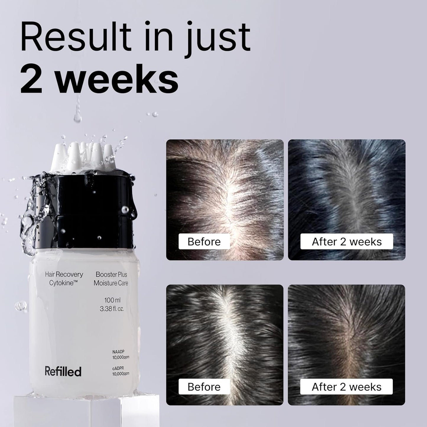 REFILLED Booster Plus Moisture | Hair Growth Serum & Thickening Scalp Treatment with Built-in Massager for Men & Women | Hair Loss & Thinning | Fuller & Baby Hair Regrowth | Fast-Absorbing with Biotin