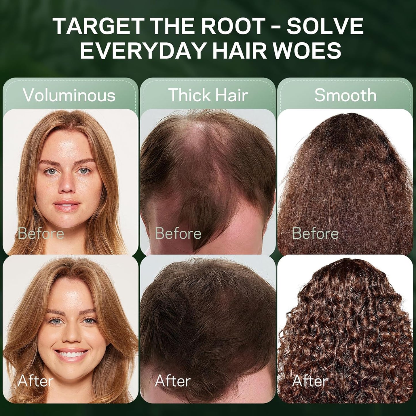 Rosemary & Hydrolyzed Keratin Hair Growth Shampoo, Organic Natural Shampoo for Thinning hair & Hair Loss with Biotin Mint Ginger Tea Tree, Paraben and Sulfate Free 10.15 fl. oz