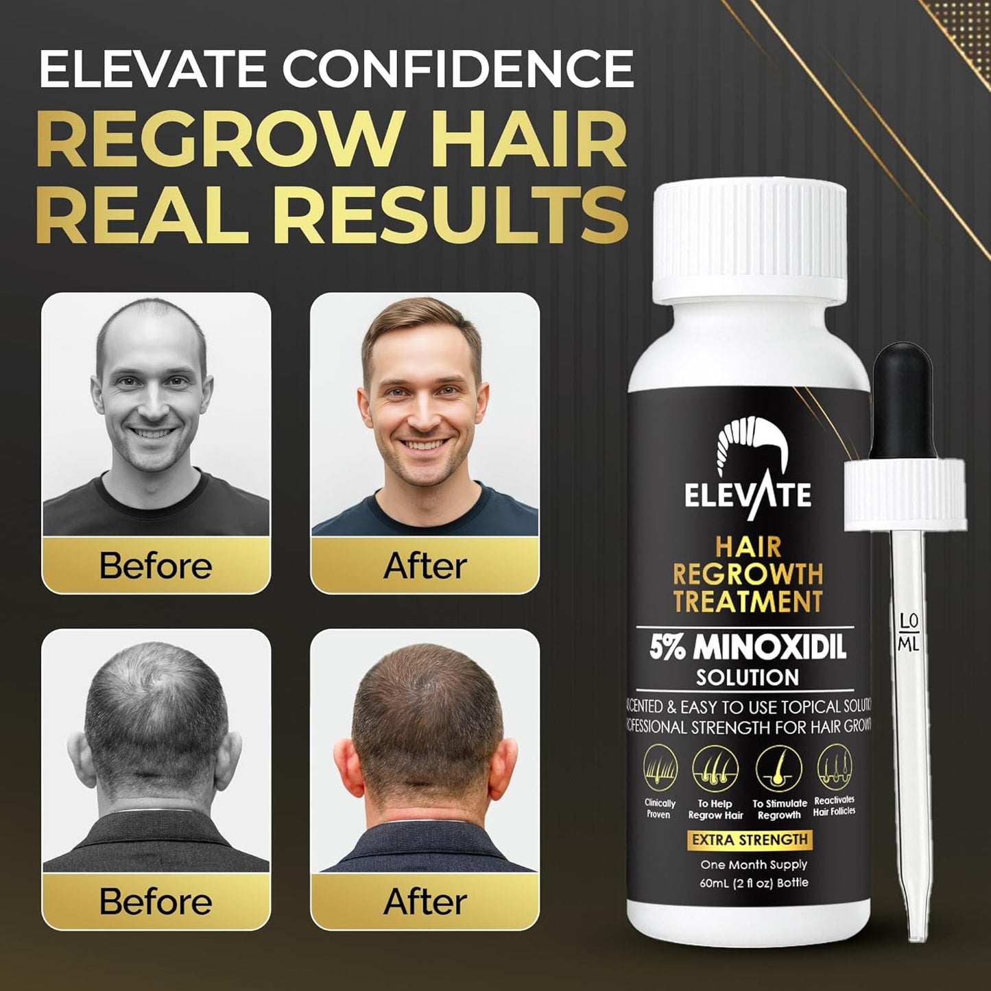 Elevate Hair Regrowth Treatment 5% Minoxidil Solution for Hair Growth - Extra Strength Topical Hair Growth Serum for Thicker, Fuller Hair 2 Fl Oz Made in USA