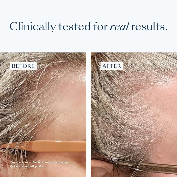 eSalon Biotin Hair Gummies, Vegan Multivitamin, Cherry & Citrus Flavor, 60 Count, 30 Day Supply