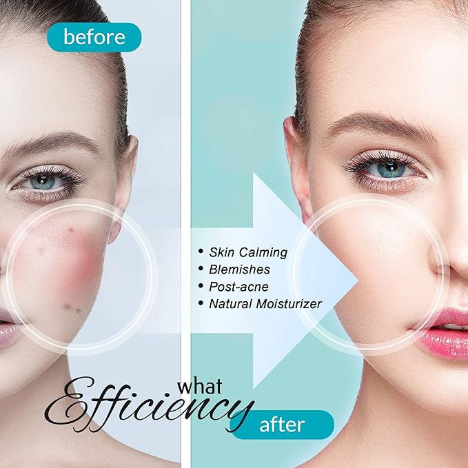 100% Pure Blue Tansy Korean Skincare Carenology Essential Facial Oil Overnight facial Repair for Acne Spot and Scar Treatment, Non-Greasy, Dermatologist Recommended for All Skin Types