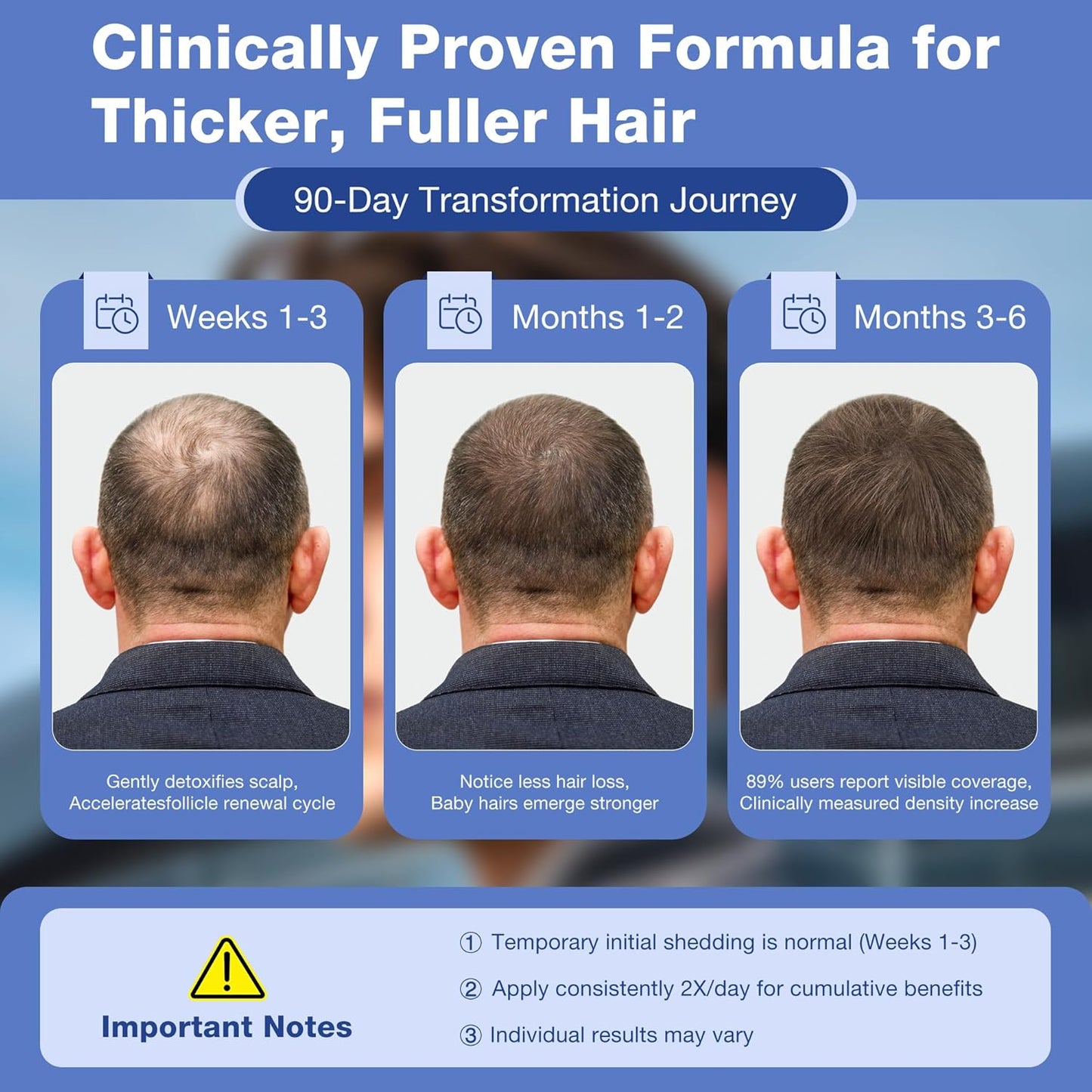 5% Minoxidil with Biotin Hair Growth Serum for Men & Women – Thicker & Healthier Hair, Topical Minoxidil to Restore Fuller Beard, 200ml (100ml×2) with Extra 80ml Volume