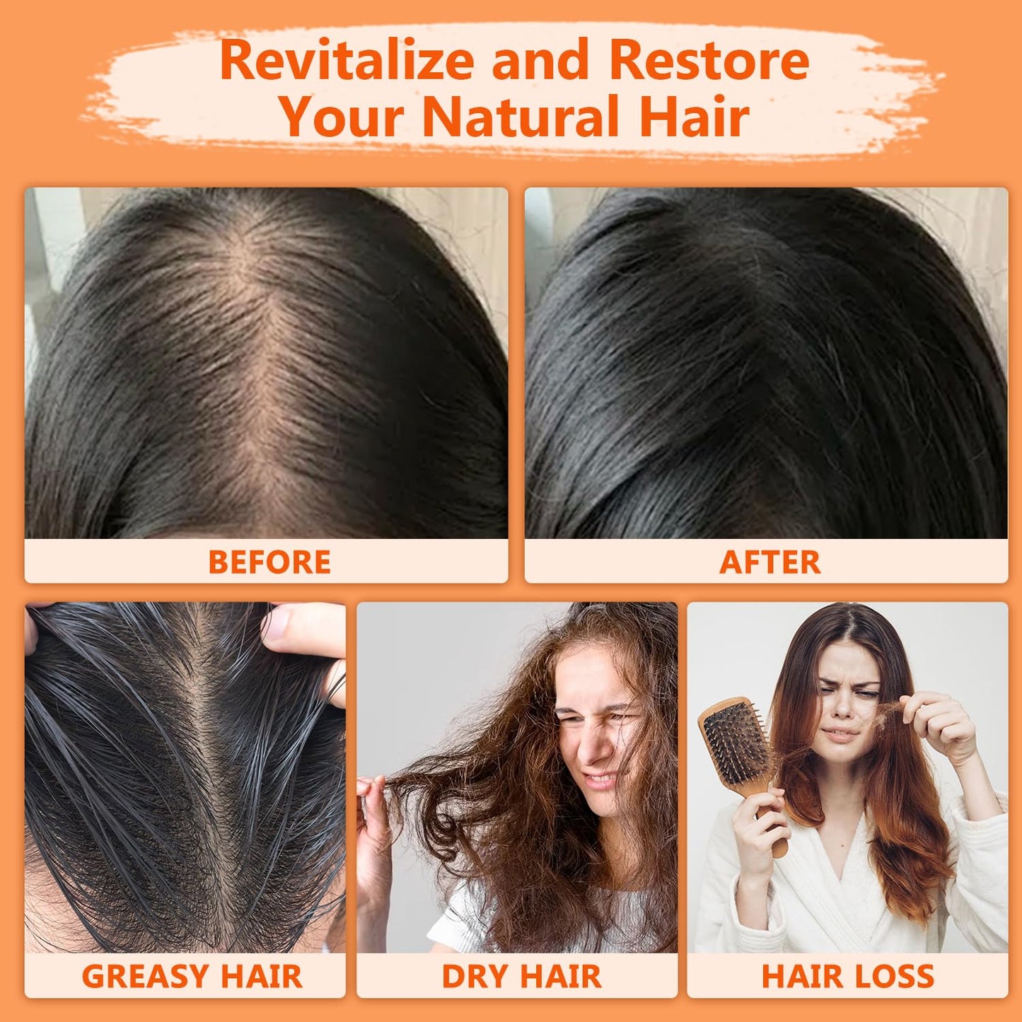 Natural Batana Hair Revival Formul, 4-in-1 Liquid Batana Oil, Batana Oil for Hair, Rosemary Oil for Hair, for Men and Women, Prevents Dry Hair & Hair Loss for All Hair Types (2PCS)