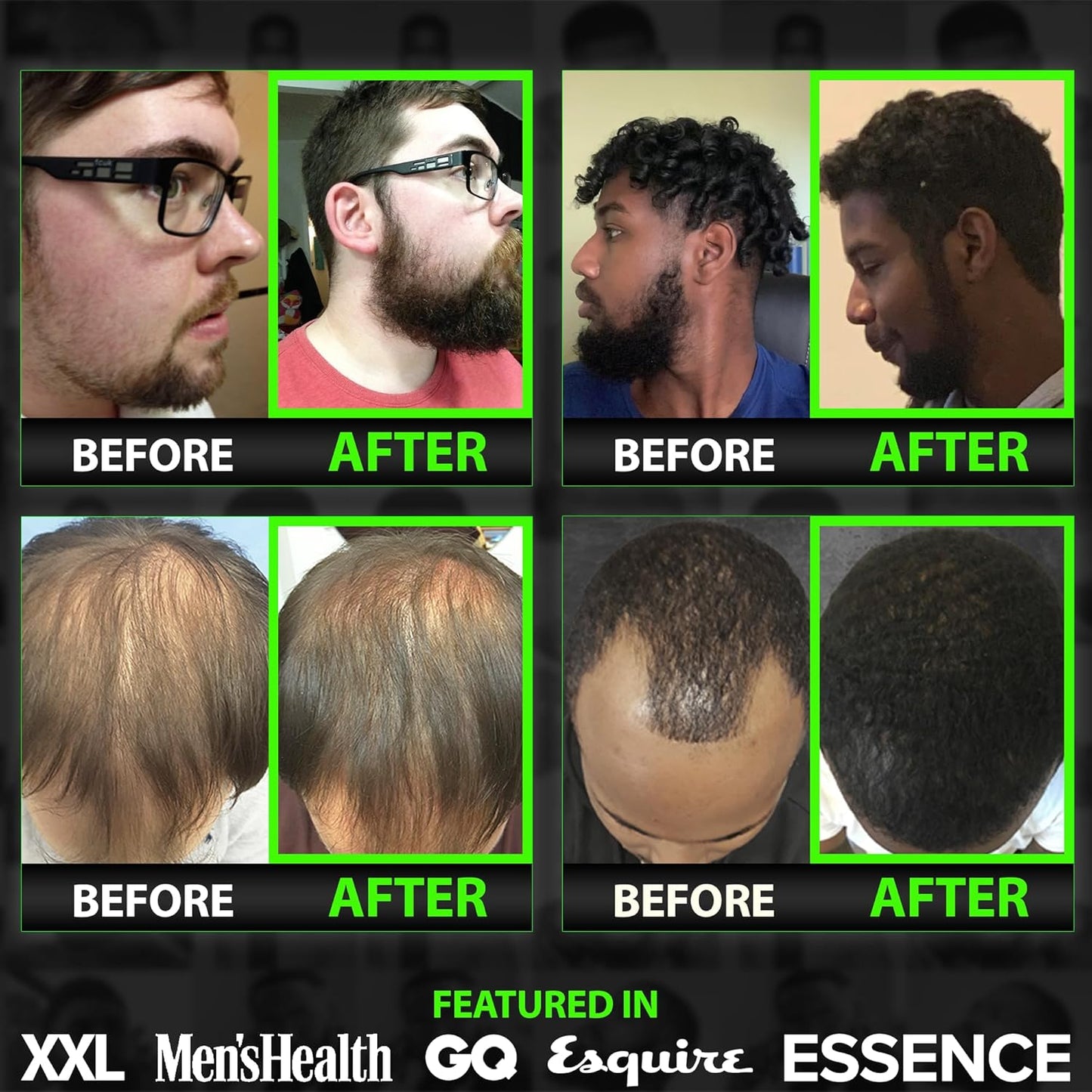 GROW Beard Growth Serum + 2X Biotin Beard Balm – Thickening Conditioner with Castor Oil & Meadowfoam – Fills Patches, Boosts Growth, Softens & Styles – For Thicker, Fuller Men's Facial Hair