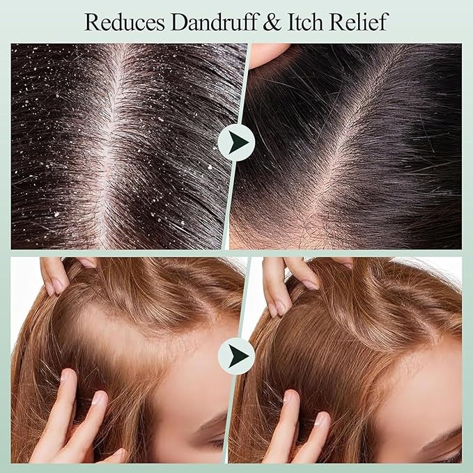 Scalp Scrub, Rosemary Mint Scalp Exfoliator Scrub with a Silicone Scalp Massager, Clarify and Remove Build Up, Deep Cleansing, Scalp Soothing, Reduce Oily Hair, Promotes Hair Growth