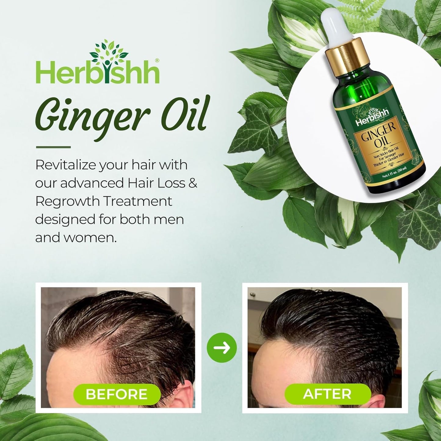Herbishh Ginger Hair Oil - Fast Thickening and Regrowth Serum for Dense Hair - Best Compact 30ml Care Product for Women & Men