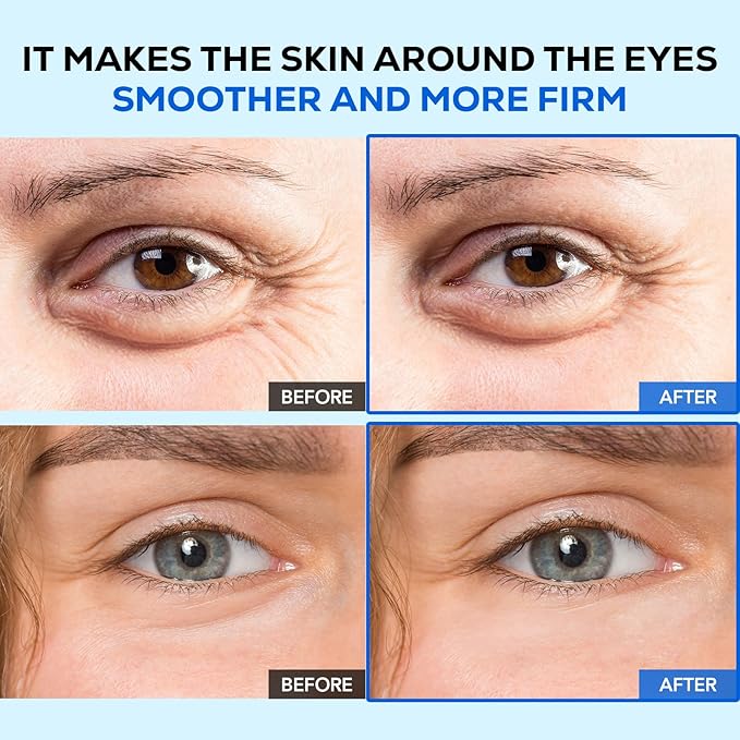 Olivia & Allison AQUA-H WRINKLE CORRECTOR EYE CARE - Adenosine + Hyaluronic Acid for Smoother & Youthful Eyes