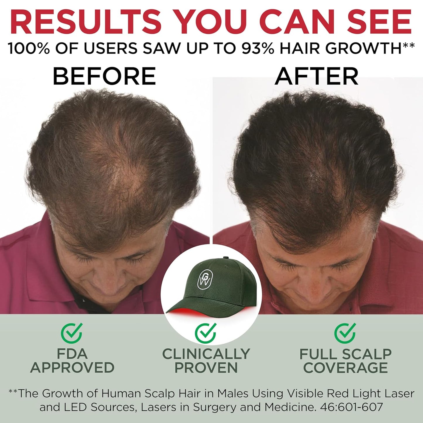 Red Light Therapy Hair Growth Cap – FDA Cleared Laser Treatment for Hair Regrowth and Reduced Shedding – LED & Laser Red Light Therapy Clinically Proven in Double-Blind Studies -Green
