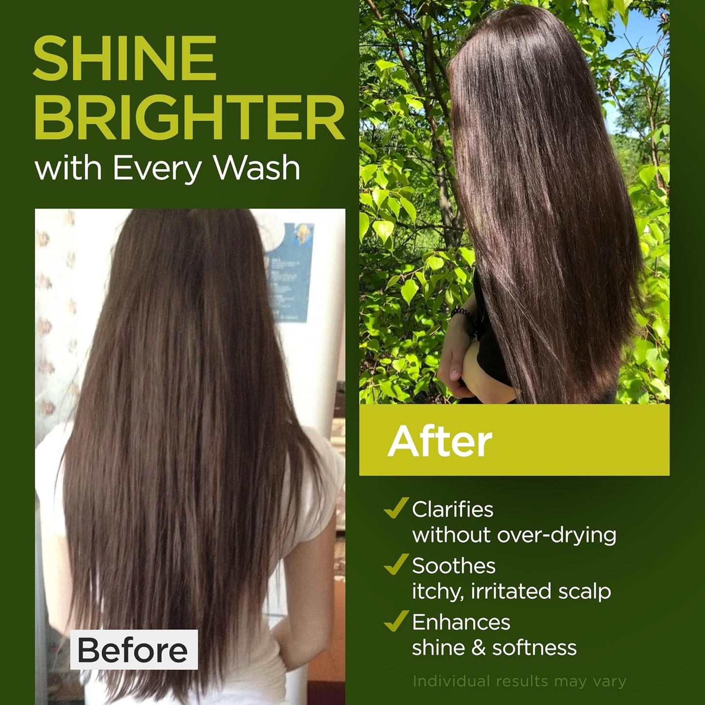 Tea Tree Rosemary Shampoo and Conditioner Set with Castor Oil for All Hair Types - Effective Cleanse and Supports Scalp Health for Women & Men Paraben & Sulfate Free (16 Oz Each)