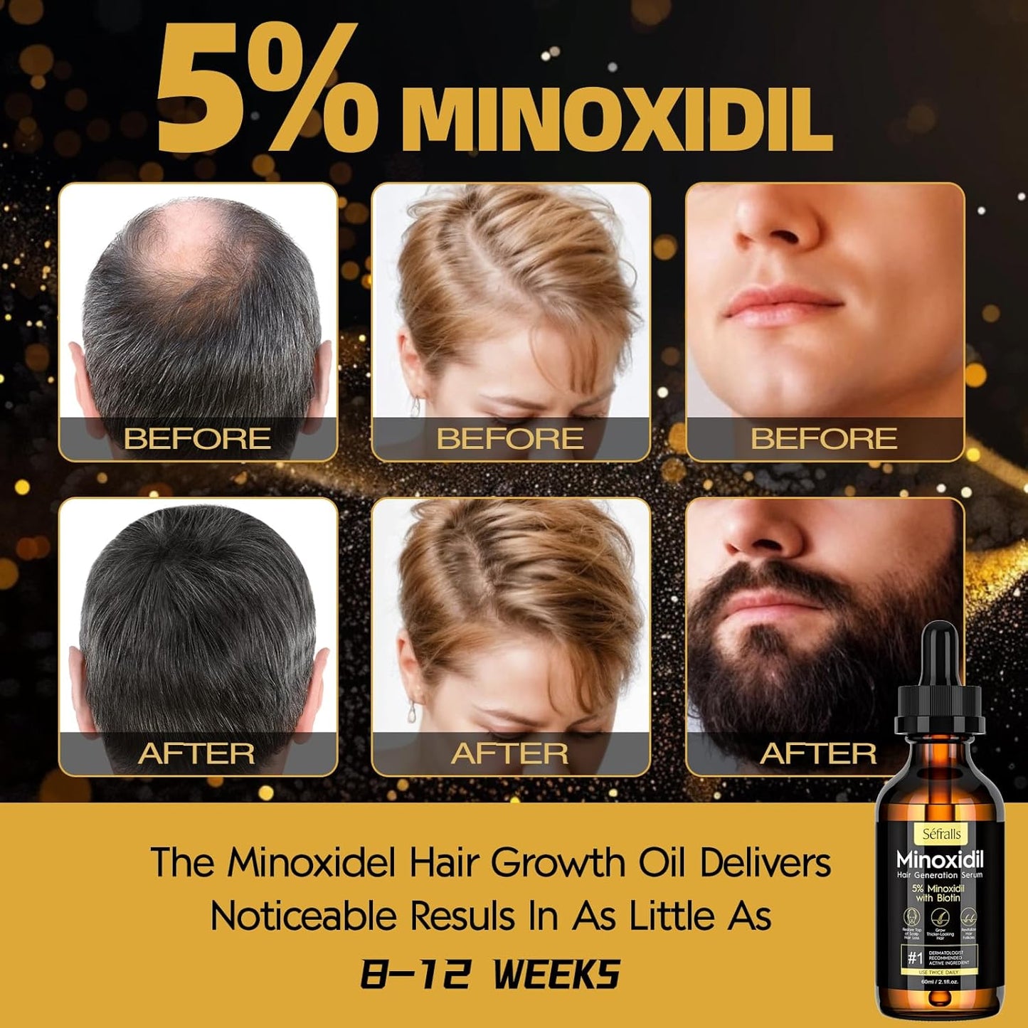 2-Pack 5% Minoxidil Hair Growth Serum for Men and Women, Hair Regrowth Treatment for Stronger, Thicker, and Longer Hair, Facial Hair Grooming and Thickening Solution