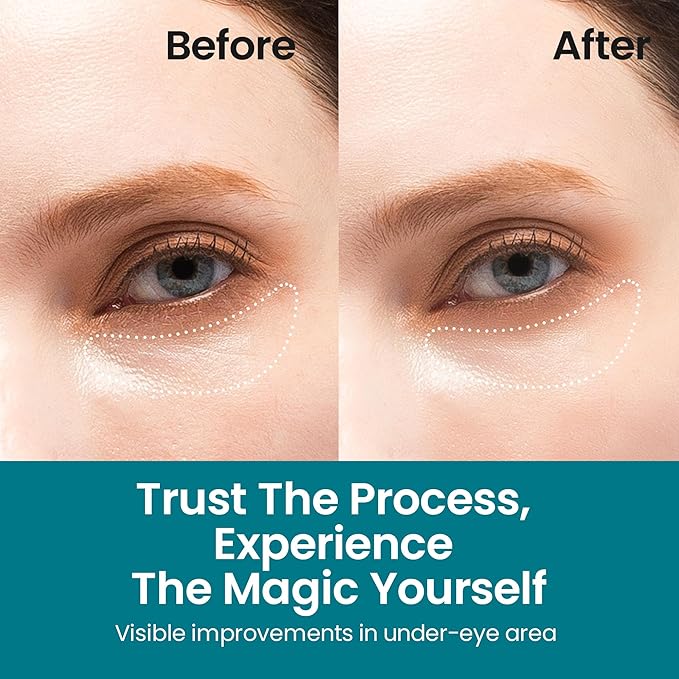 Under Eye Patches for Dark Circles | Korean Under Eye Patches & Puffy Eye Patches | Moisturizing Dark Circles Under Eye Treatment Skincare Snail Mucin Eye Patches & Dark Eyes Circle Treatment