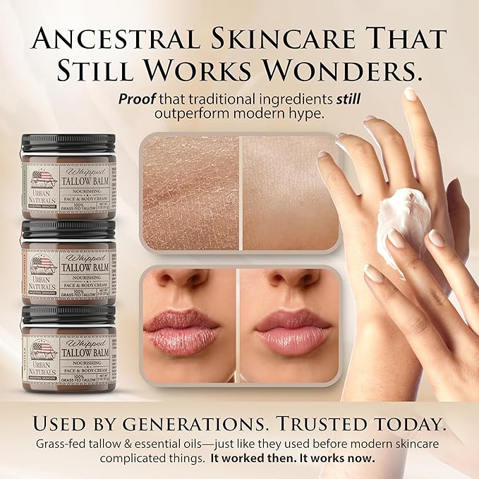 Urban Naturals Handmade Whipped Tallow Balm (Unscented/Herb-Infused) - 100% Grass-fed Organic Body Butter with Infused Jojoba Oil, for Eczema, Rosacea, Baby - 2 oz