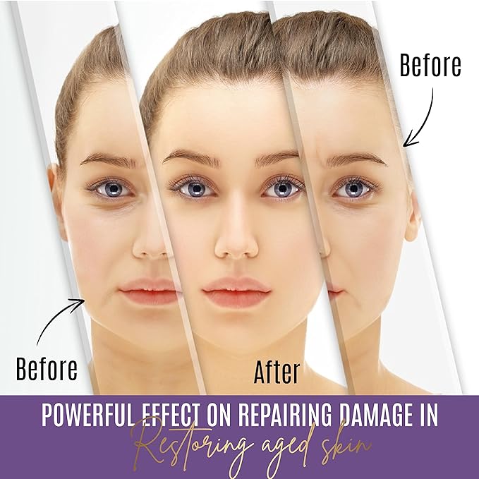 Matrixyl Face Cream – Skin Elasticity Repair Cream - Peptides Booster with Vitamins C and E, Hyaluronic Acid, Aloe Vera - Anti Wrinkle Cream – 1.7fl oz