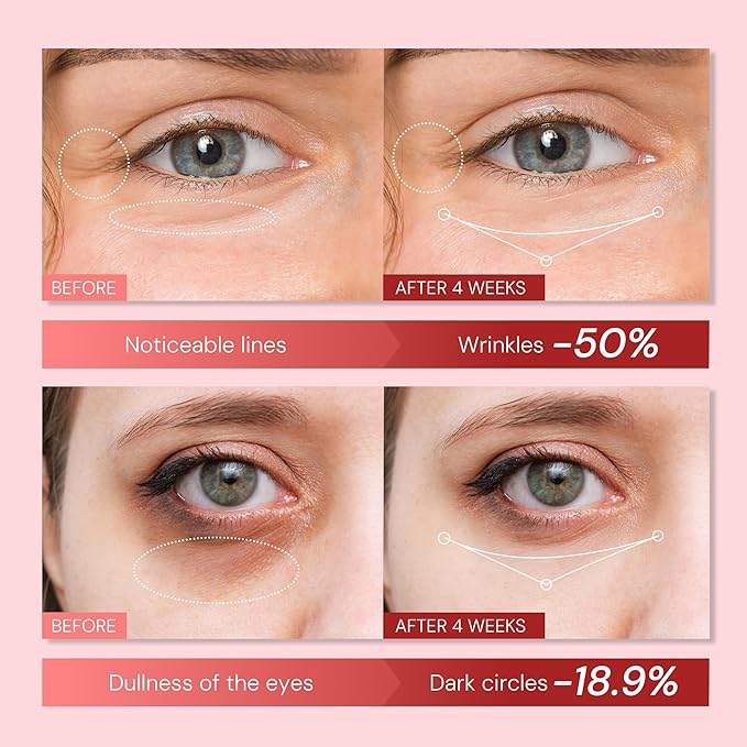 Retinol & Polypeptides Anti-Aging Eye Cream: Under Eye Treatment Reduces Wrinkles, Fine Lines, Dark Circles, Crow’s Feet & Puffiness – 0.85 Fl Oz