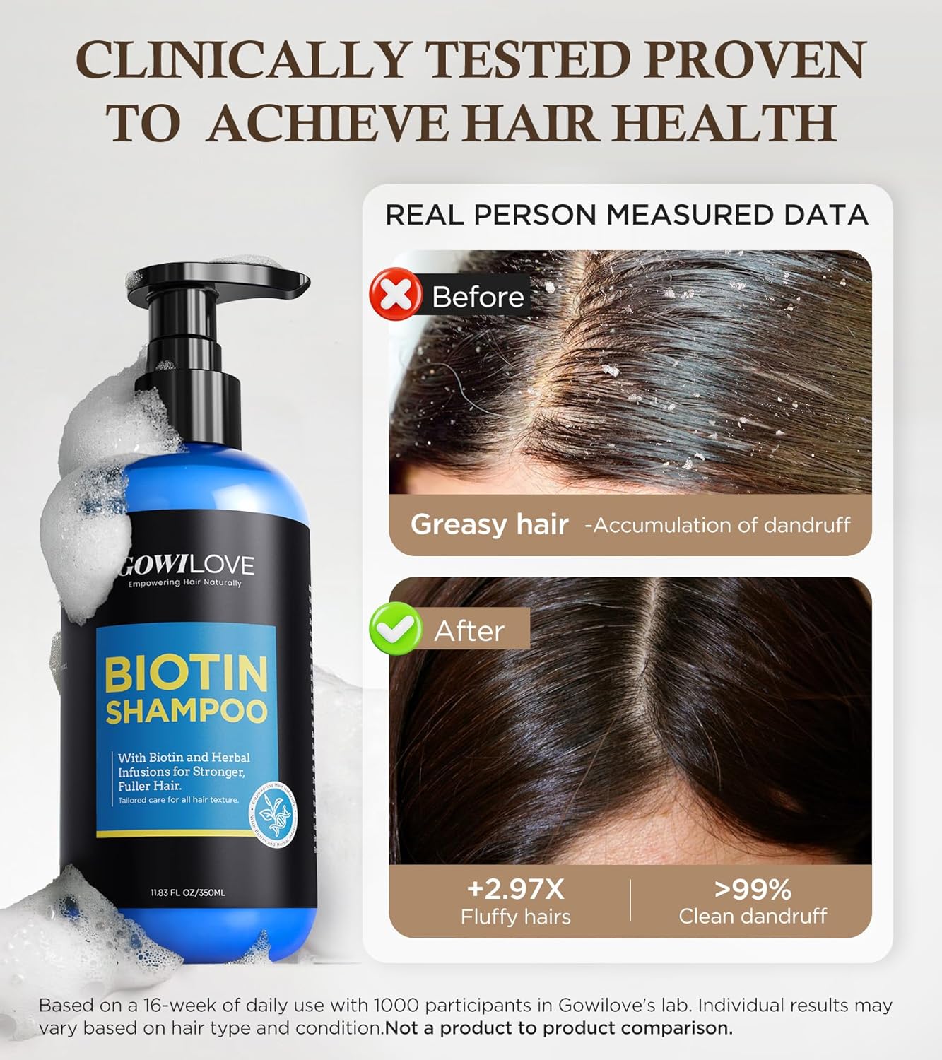 99% Pure Biotin Shampoo for 3X Thicker, Fuller Hair Growth, 80% Less Hair Loss w/Thuja Extract, Batana & Noni Fruit Oil Hair Care for Deep Nourishing,Rosemary Dandruff Treatment for Men Women,11.83oz