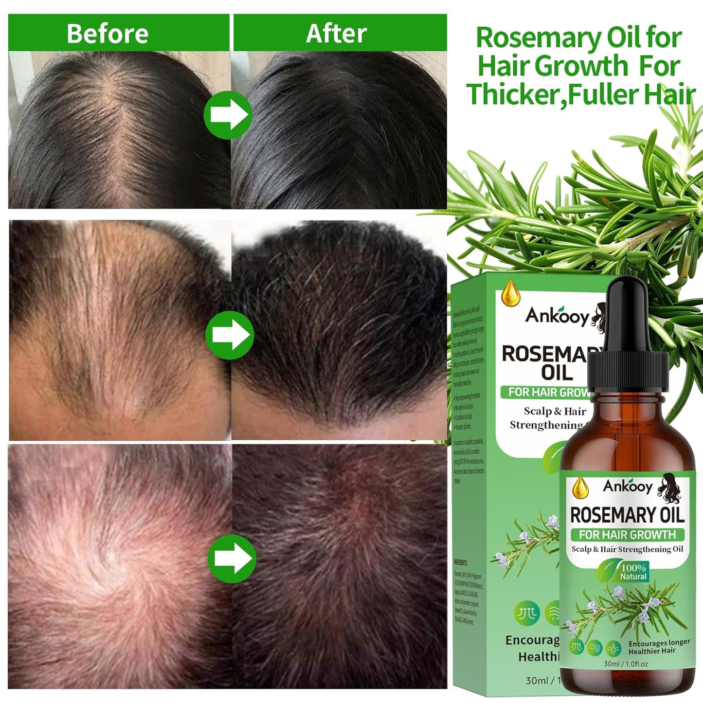 2 Pack Rosemary Oil for Hair Growth,Rosemary Hair Growth Oil,Hair Strengthening Serum for Dry Damaged Hair,Hair Loss Treatment & Thickens Hair,Scalp Care Promotes Hair Thickness for Men Women
