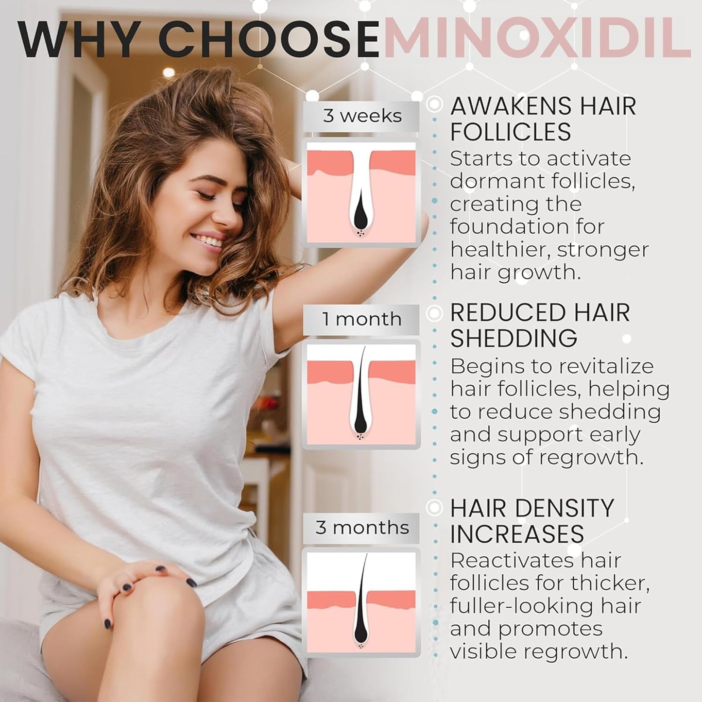 Minoxidil for Women | 5% Minoxidil For Women Hair Growth | Hair Regrowth Treatment | Unscented Topical Foam | Dermatologist Recommended | Clinically Proven Formula | 3 Month Supply