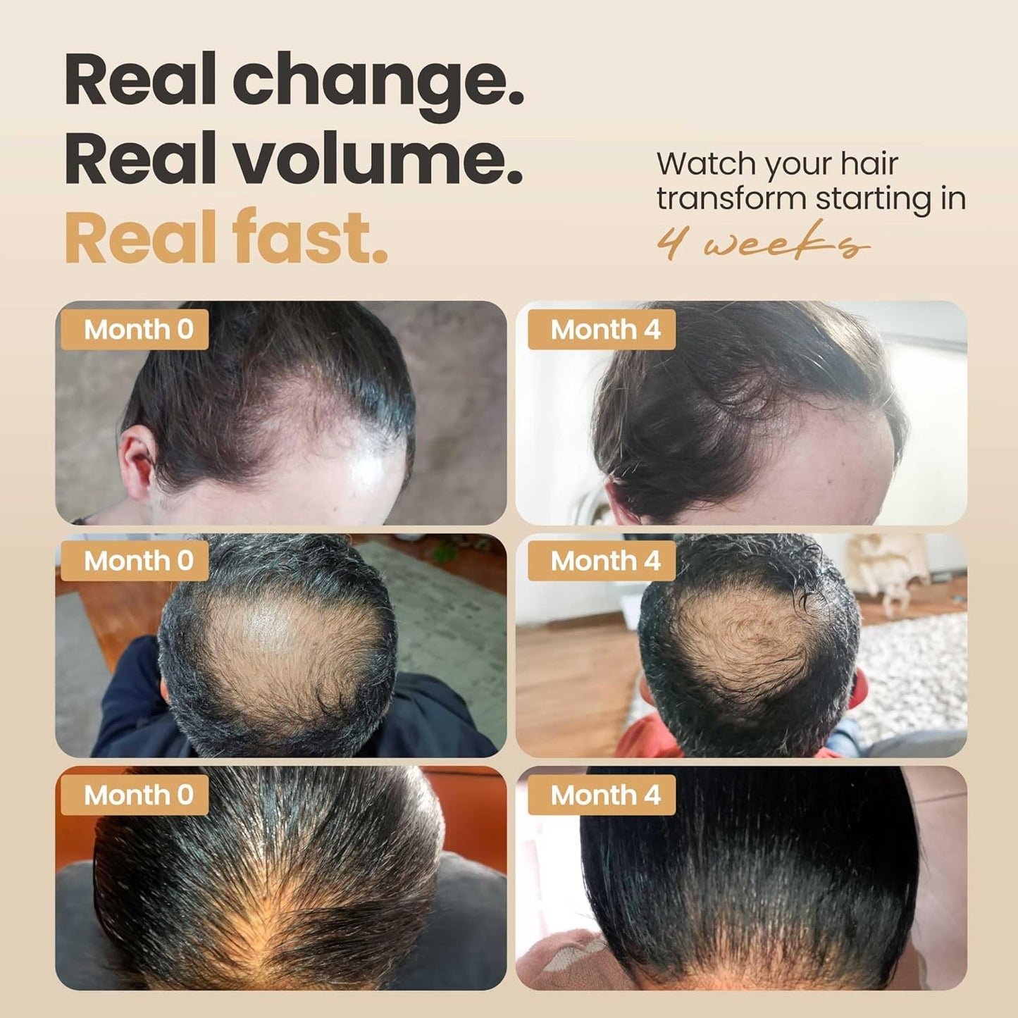 Hair Booster for Women & Men – Hair Revitalizing Serum with Capilia Longa & Arginine for Thick, Dry, Long, Damaged Hair – Peptide-Enriched Hair Tonic, 2 Fl Oz - Pack of 2