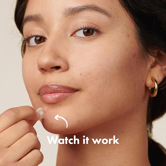 Mighty Patch™ Original Patch - Hydrocolloid Acne Pimple Patch for Covering Zits and Blemishes, Spot Stickers for Face and Skin (75 Count)