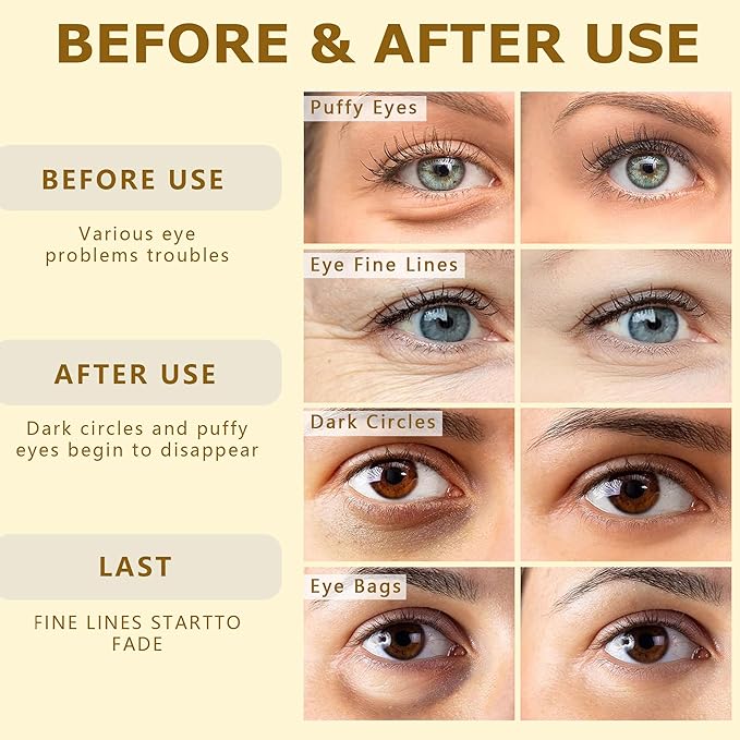 Gold Under Eye Patches-60 Pcs Eye Masks | Anti-Aging |Boost Lift & Firm the Look of the Eye Area |Eye Patches for Puffiness,Bags,Dark Circles (60 Count (Pack of 1), Under Eye Patches)